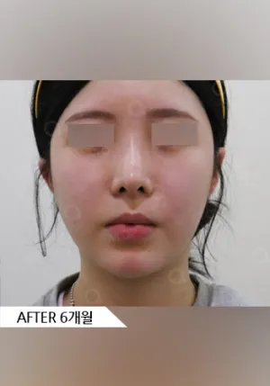 After