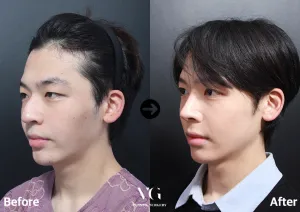 After