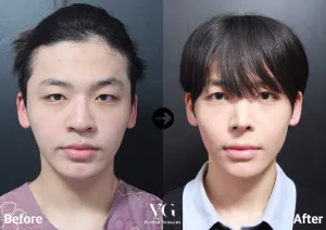 Before