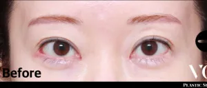 Before