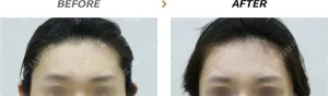 Before