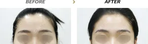 Before