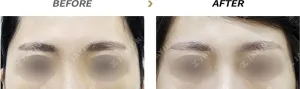 Before