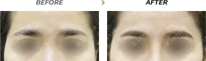 Before