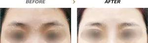 Before