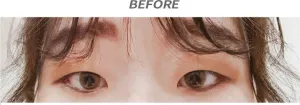 Before