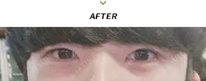 After
