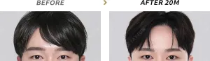 Before