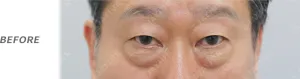 Before