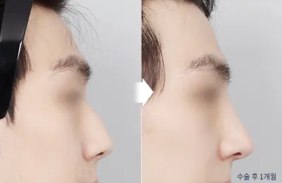 Before & After