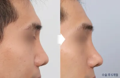 Before & After
