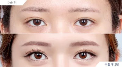 Before & After