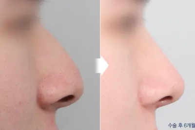 Before & After