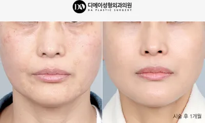 Before & After