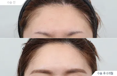 Before & After