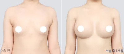 Before & After