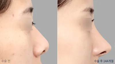Before & After