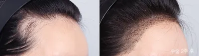 Before & After