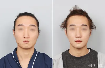 Before & After