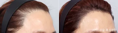 Before & After