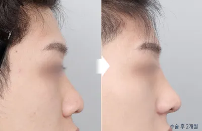 Before & After