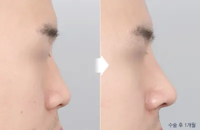 Before & After