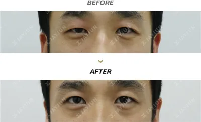 Before & After