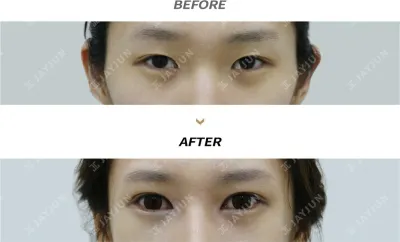 Before & After