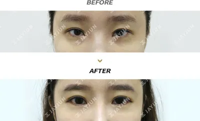 Before & After