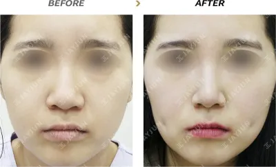 Before & After