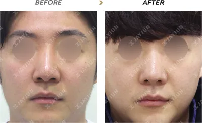 Before & After