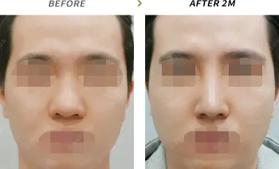 Before & After