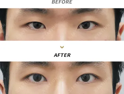 Before & After