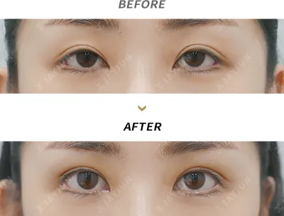 Before & After