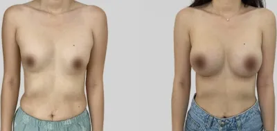 Before & After