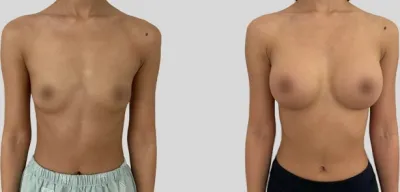 Before & After