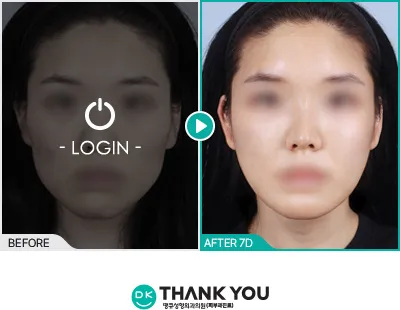 Before & After