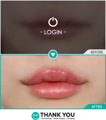 Before & After