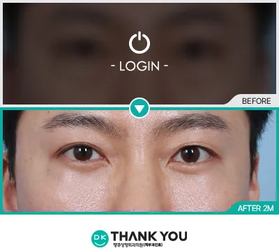 Before & After