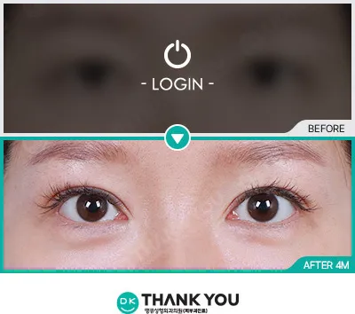 Before & After