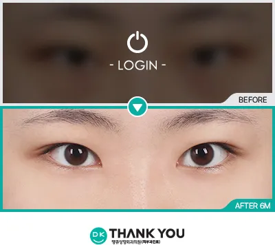 Before & After