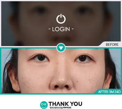 Before & After
