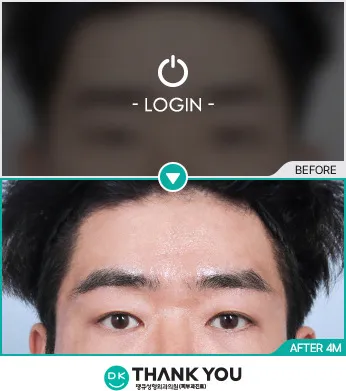 Before & After