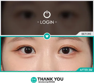 Before & After