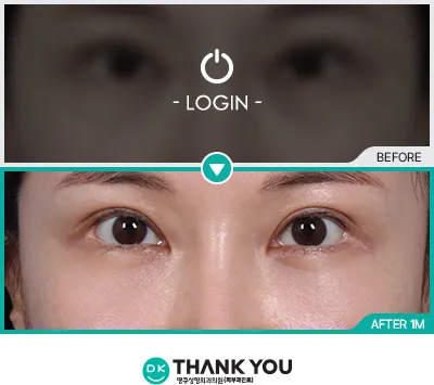 Before & After