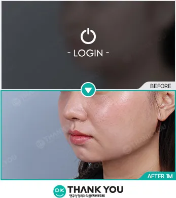 Before & After