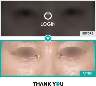 Before & After