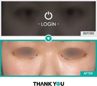 Before & After
