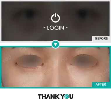 Before & After