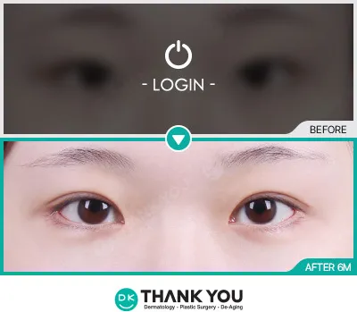Before & After